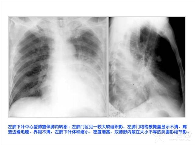 必看100张放射美图让你学会x线