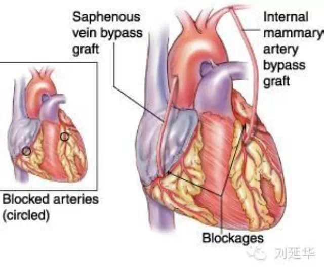 心脏搭脉怎么治疗_心脏位置