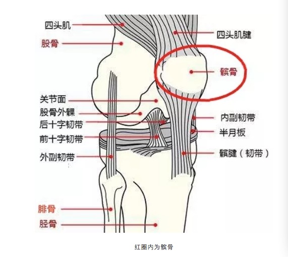 珠海发现首例股骨罕见畸形,膝关节经常脱位,医生这样来治疗