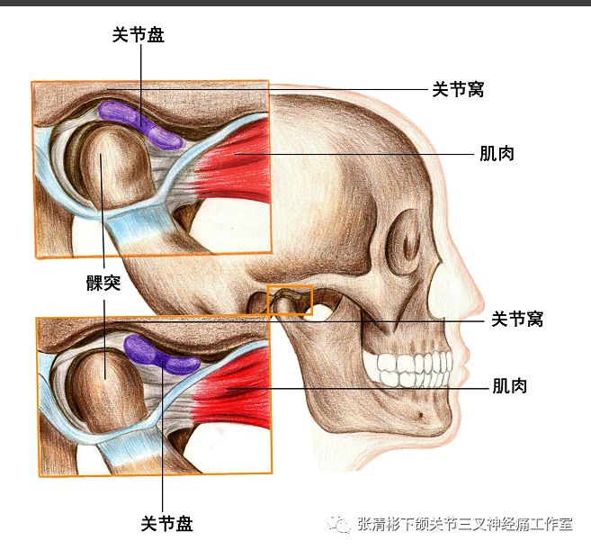 颞下颌关节脱位颞下颌关节盘移位