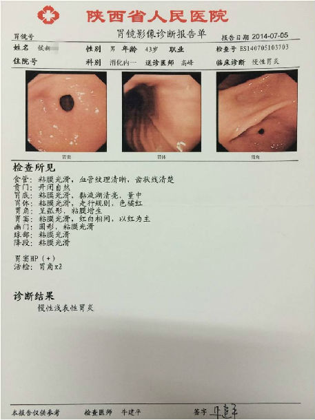 膏方治疗萎缩性胃炎患者的胃镜,病理前后对照(图片)