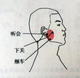 松解咬肌和颞肌(1)咬肌的松解首先找到咬肌的位置,然后三个手指在这个