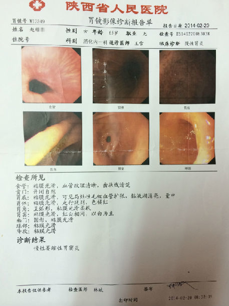 膏方治疗萎缩性胃炎患者的胃镜,病理前后对照(图片)