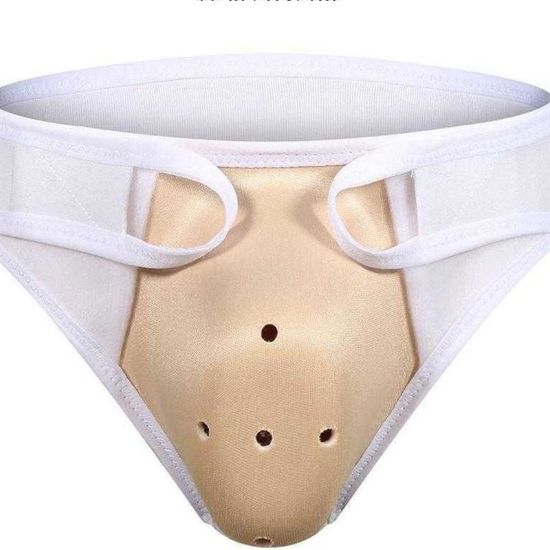 图1(2))用一次性纸杯制作简易保护罩(图1)或网上购买包皮术后保护内裤