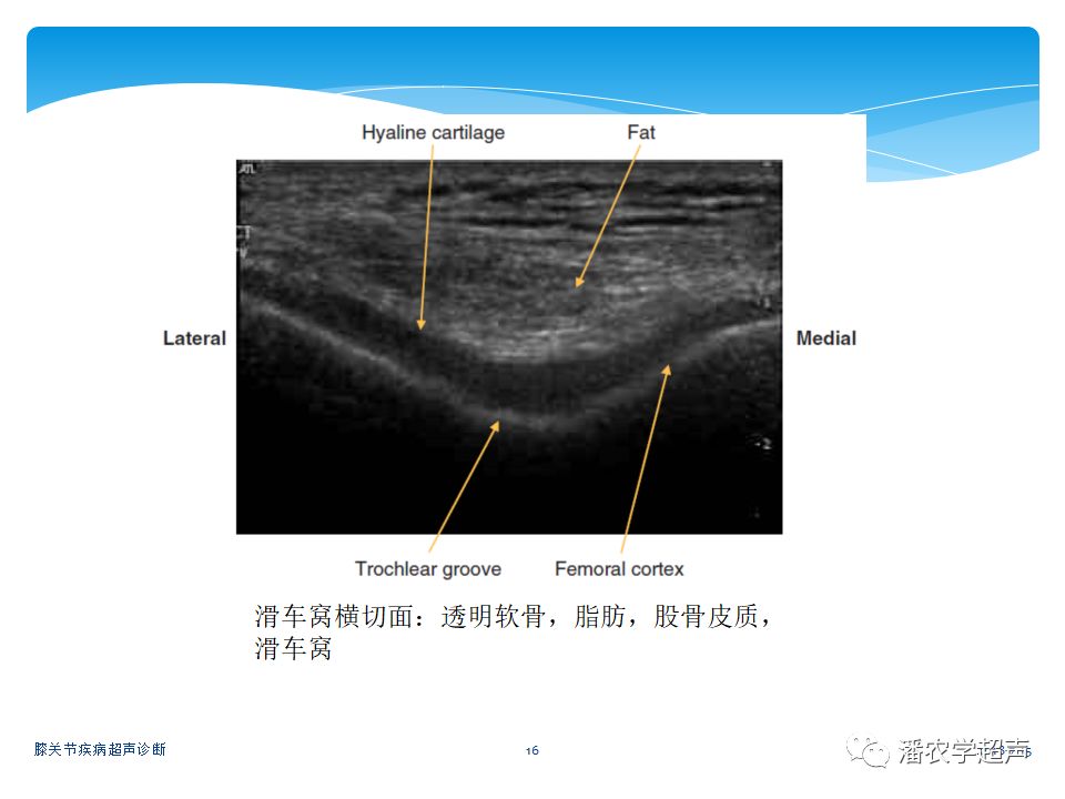 超声微课堂膝关节疾病超声诊断膝前区检查方法与解剖