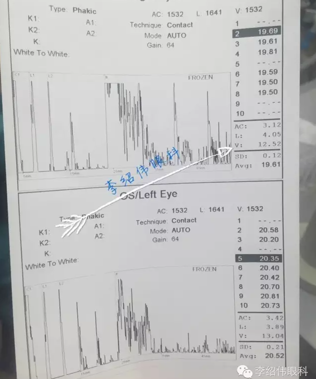 婴儿先天性角膜白斑怎么办