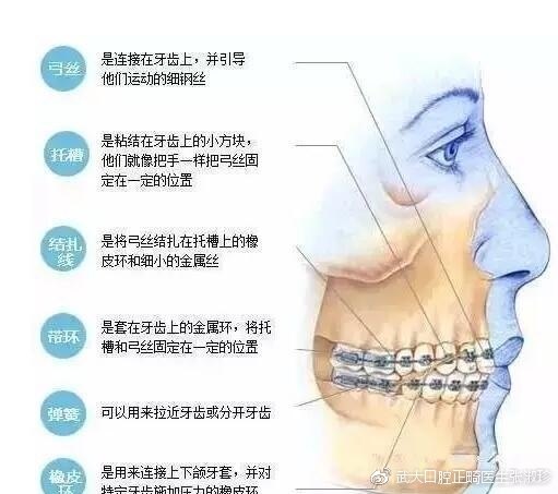 正畸牙齿移动的原理_正畸中牙齿移动的原理