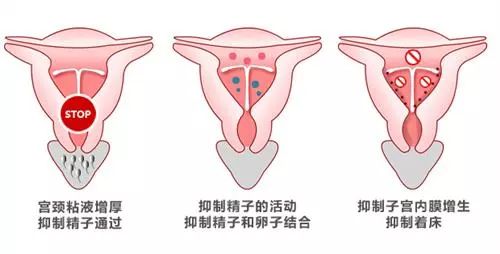 上环后经期延长怎么办