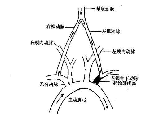 主要为双上肢供血,左侧锁骨下动脉自主动脉弓直接分出,右侧锁骨下动脉