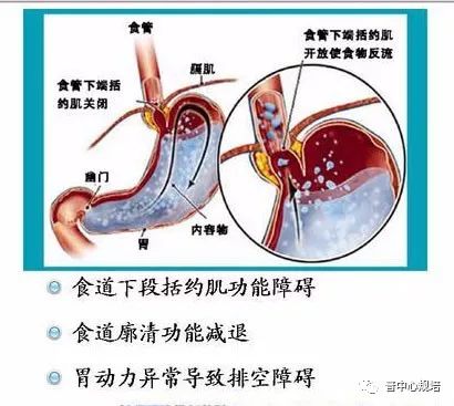 慢性咽喉炎元凶竟是它