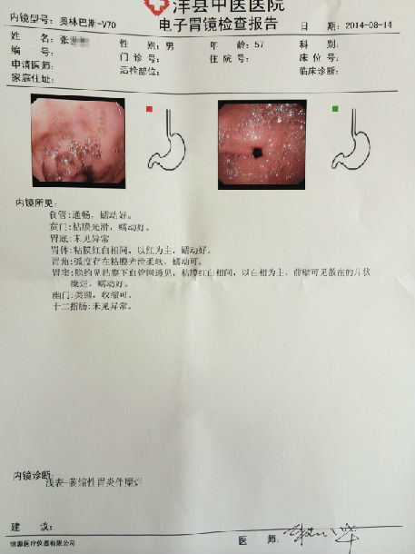 疗后为"慢性浅表性胃炎伴胆汁渗出". 疗前胃镜报告