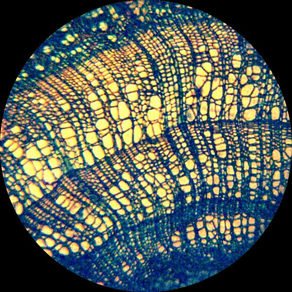 椴木(椴树)茎显微镜摄影 (图片来源网络)