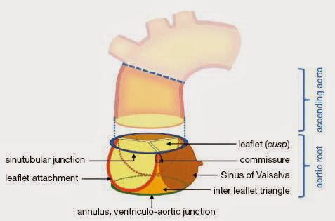 主动脉根部(aortic root) 包括球管交界,主动脉瓣,主动脉瓣环,主动脉