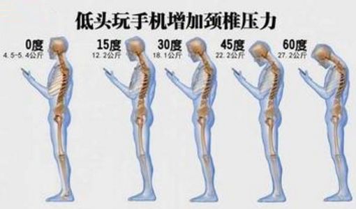 弯曲约60度,颈椎间盘承受的压力会达到27公斤,相当于一个7岁儿童的
