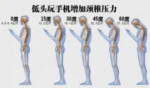 睡硬板床对颈椎好?女性更易得颈椎病?关于颈椎病你必须知道这些事