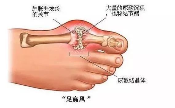 低压94怎么办