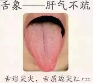 舌头是人体健康的"放大镜",教你看6种基本舌象!