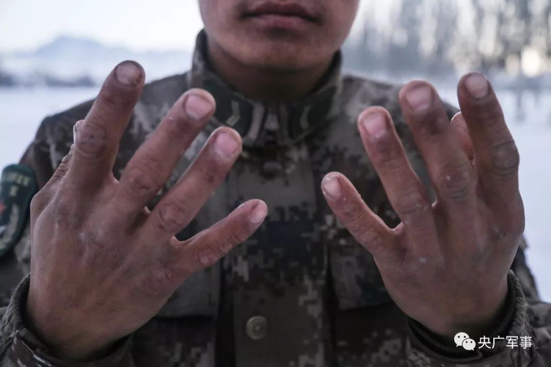 参训后战士被冻僵的手崖壁攀登在零下20度的茫茫雪海中,参训官兵们个