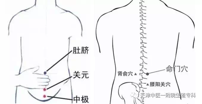 火针去皱疗法是什么原理_火针疗法图片