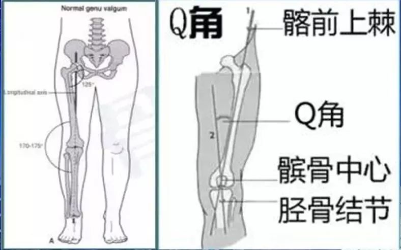 alpha角:仰卧水平投照侧位片(需要髋部内旋10度,指从股骨头中心与