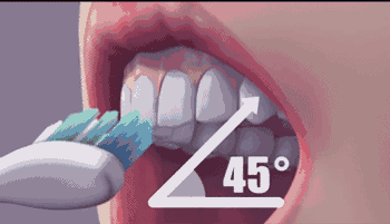 1個吻傳遞8000萬細菌，不好好刷牙的人憑「實力」單身 健康 第5張