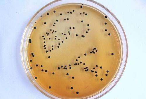 salmonellosis)是指伤寒,副伤寒以外的各种沙门菌所引起的急性传染病