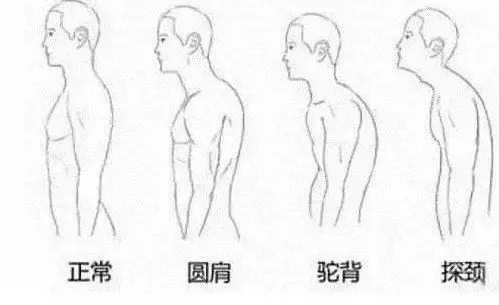 2分钟视频:含胸驼背既颜值又伤气质,快跟着视频练这4个动作!