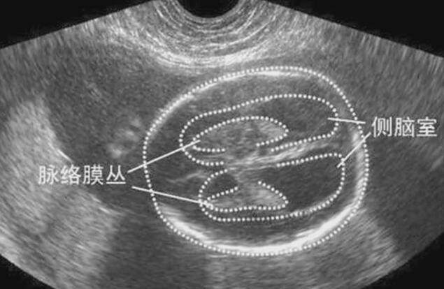 四维彩超结果怎么看？学会自己看四维彩超，孕妈们知道这些就够了