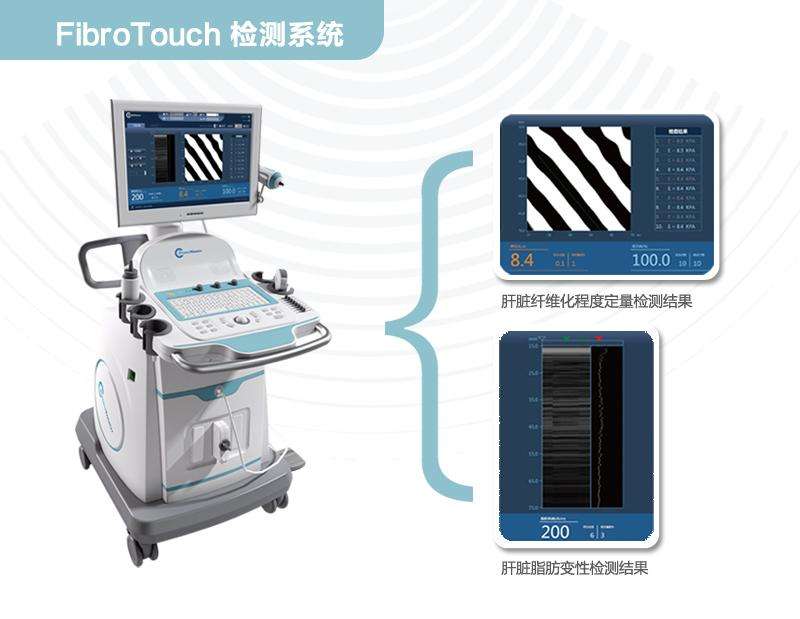 我国丙型肝炎诊断迎来新标准 海斯凯尔fibrotouch实力入选