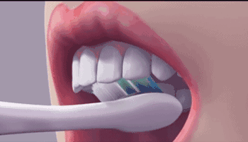 1個吻傳遞8000萬細菌，不好好刷牙的人憑「實力」單身 健康 第8張