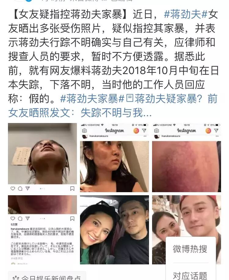 蔣勁夫女友受傷，疑似遭遇家暴，男方失蹤後卻承認：對不起！ 娛樂 第5張