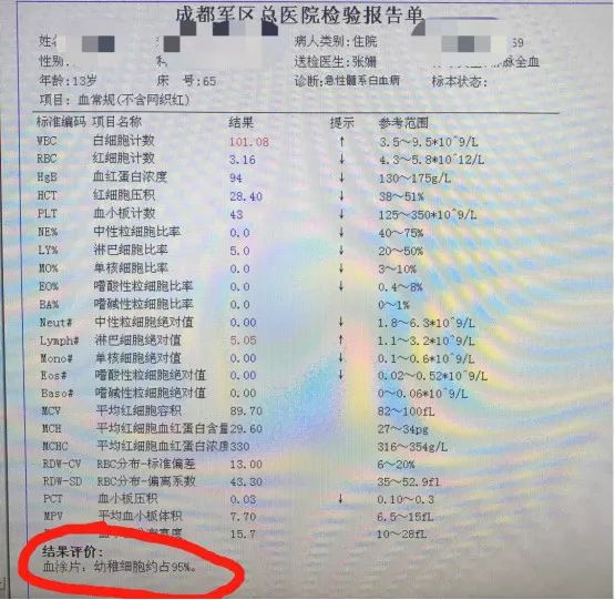 图 20:我院一例难治复发白血病患者的血常规,白血病细胞高达 95%我院