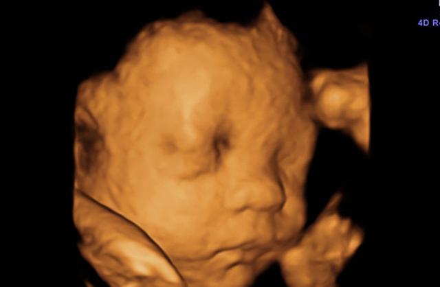 怀孕6个月,宝宝四维拍照嘴巴和鼻子都,生出来后是