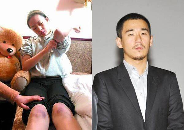 日本女友公开身体淤青照片,蒋劲夫承认家暴