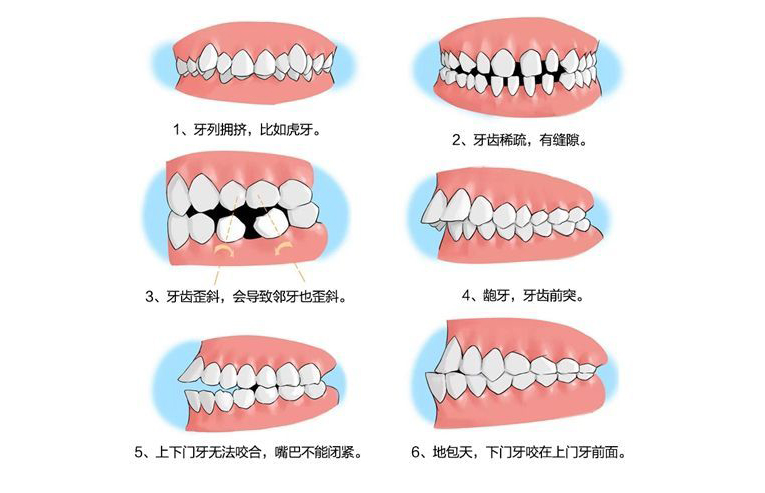 什么因素会导致儿童牙齿排列不整齐?