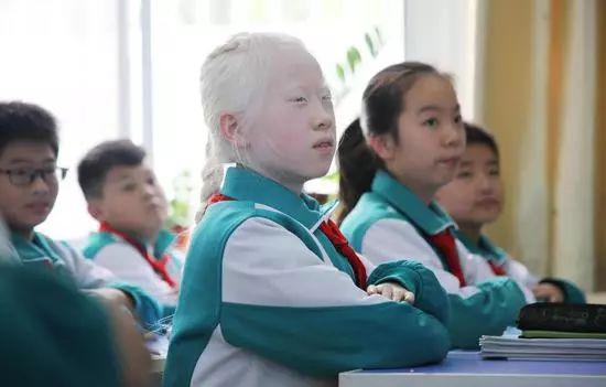 濮阳11岁白化病女孩视力仅0.04,同学和老师这样对待她