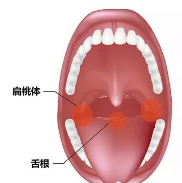 鱼刺卡肉里面怎么办