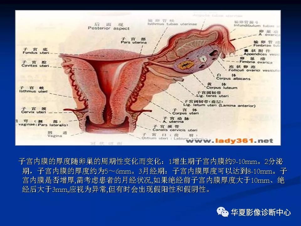 女性盆腔解剖及常见病变的mri诊断