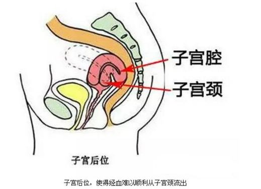 子宮後位會影響懷孕嗎？關於宮後位你不知道的事... 親子 第1張