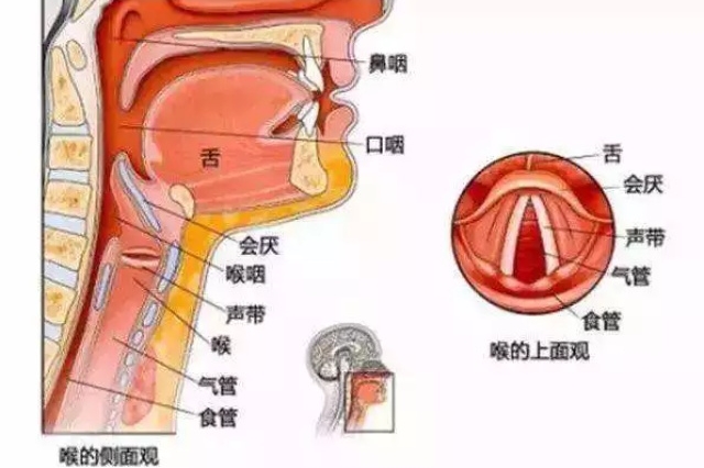 会厌,位于人体舌根部,急性会厌炎,来势凶猛,很容易肿胀堵住气管造成