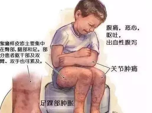 小孩过敏肚子疼怎么办