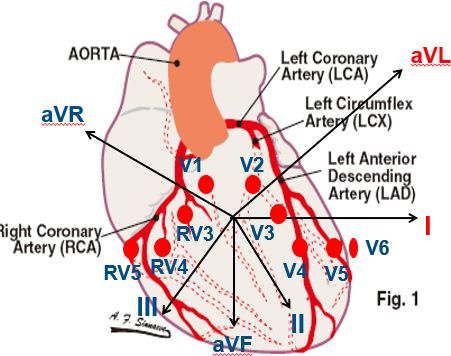 图7:高侧壁与心脏解剖所对应的位置歌词:ii,iii,avf和v5,v6一起,st段