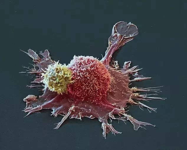 史上最清晰的cart细胞与癌细胞搏斗图像