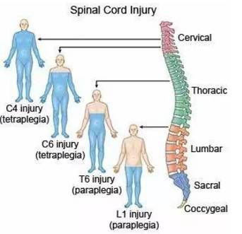 【最新资讯】日本诱导多能干细胞(ipsc)治疗脊髓损伤临床试验提交申请