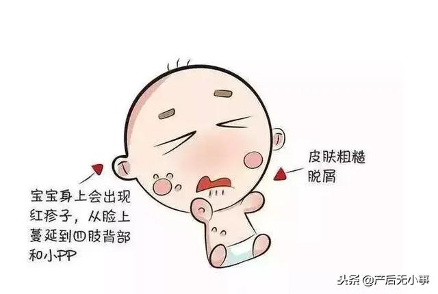 产后无小事 宝宝的皮肤又红又皴!这5大护肤误区别碰!