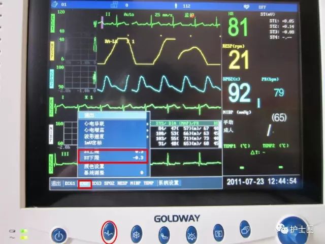 【干货】心电监护仪的操作及注意事项,很实用的ppt!