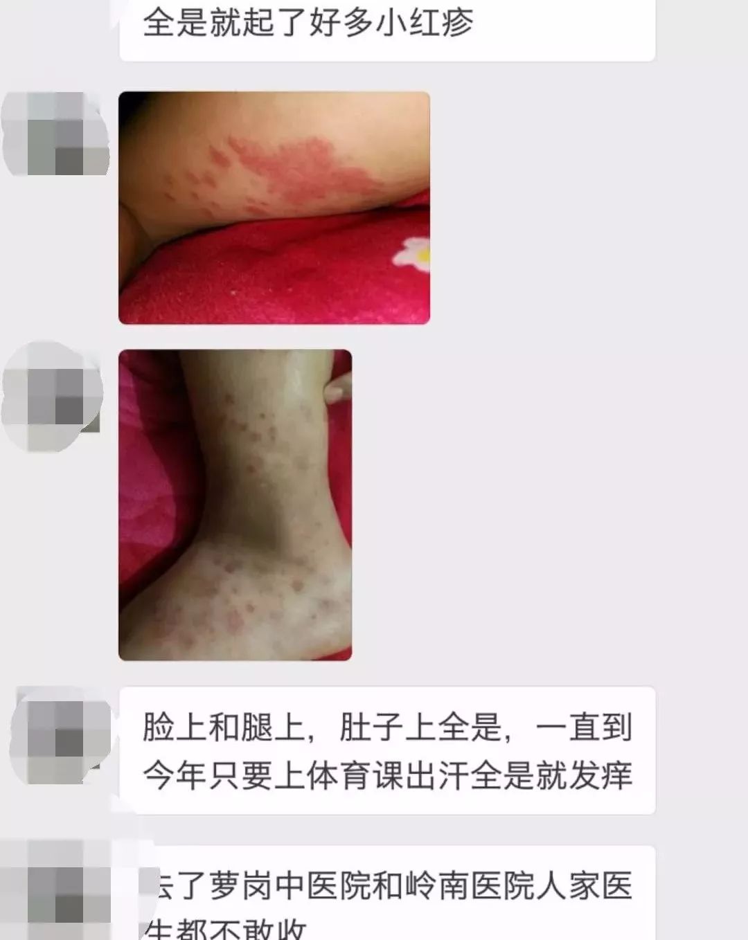 小画家患白血病后她同学也可能