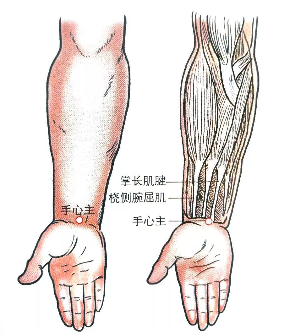 手 心 主 【定位】位于腕掌横纹上,掌长肌腱与桡侧腕屈肌腱之间点.