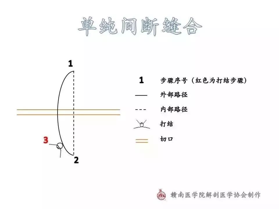 图解常用外科缝合路径示意图