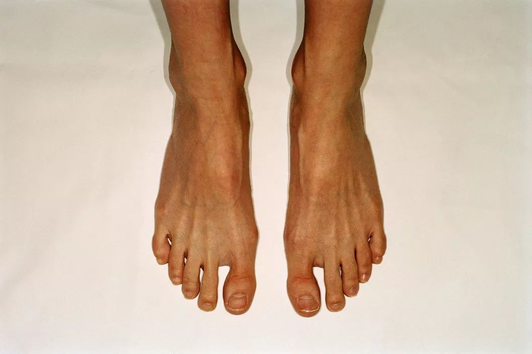 feet | martin parr